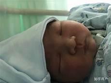 娘娘生孩子皇上堵住不让生